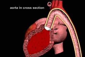 Aortic anatomy and function