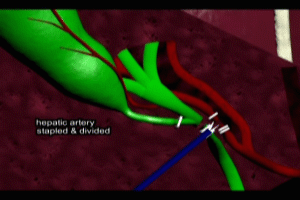 Cytic Duct Hepatic Artery