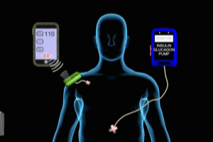 Bionic Pancreas