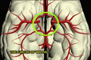 Circle of Willis