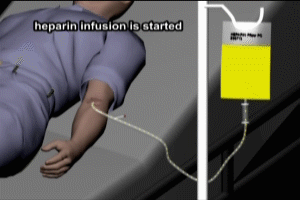 Heparin and Pulmonary Embolism