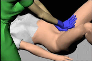 Suprapubic Pressure for Fetal Shoulder Dystocia