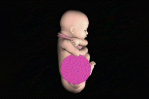 Nuchal Umbilical Cord