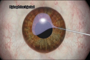 Epinephrine Metabolism In The Eye