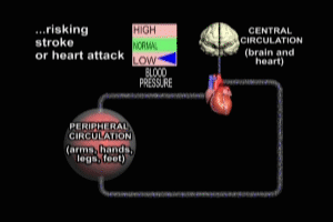 Pressors and Shock Video - Trial Image Inc.