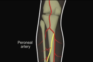 Lower Limb Arterial Anatomy