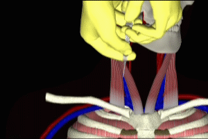 Subclavian Vein Access in Normovolemic Patient