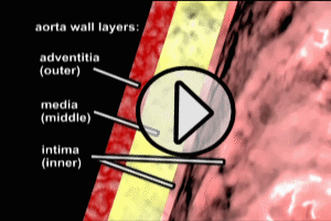 Aortic Anatomy