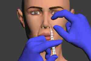 facial injection