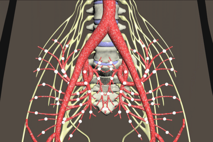iliac artery embolism