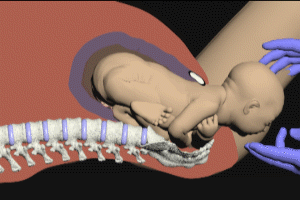 Motion in Medical Animation