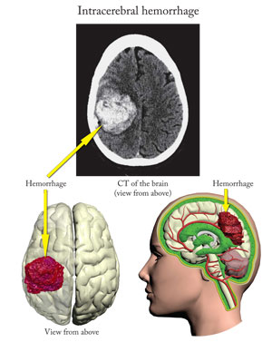 Custom Medical Illustrations - Trial Image Inc.