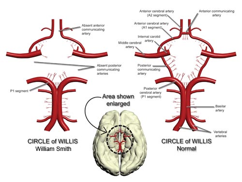 circle of willis