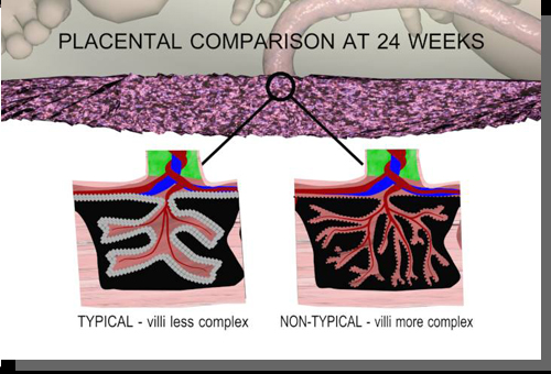 placental villi