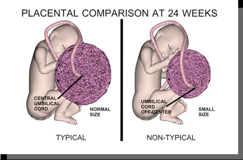 abnormal placental size