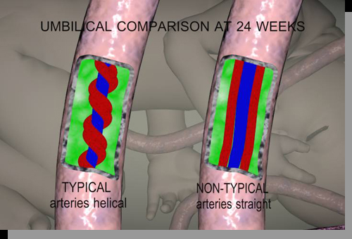 umbilical cord cross-section